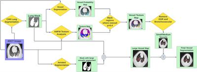 CT-derived vessel segmentation for analysis of post-radiation therapy changes in vasculature and perfusion